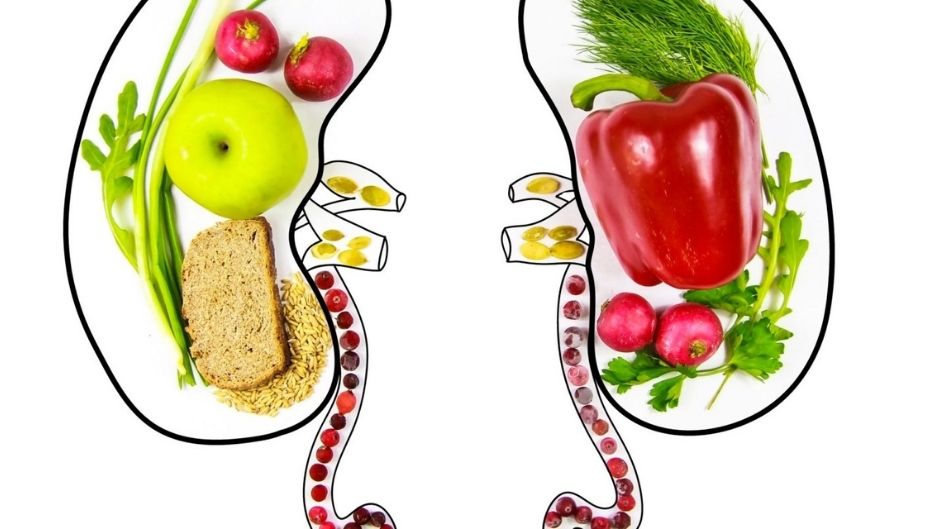 Plant-Based Whole Food Diet Prevents and Cures Kidney Stones